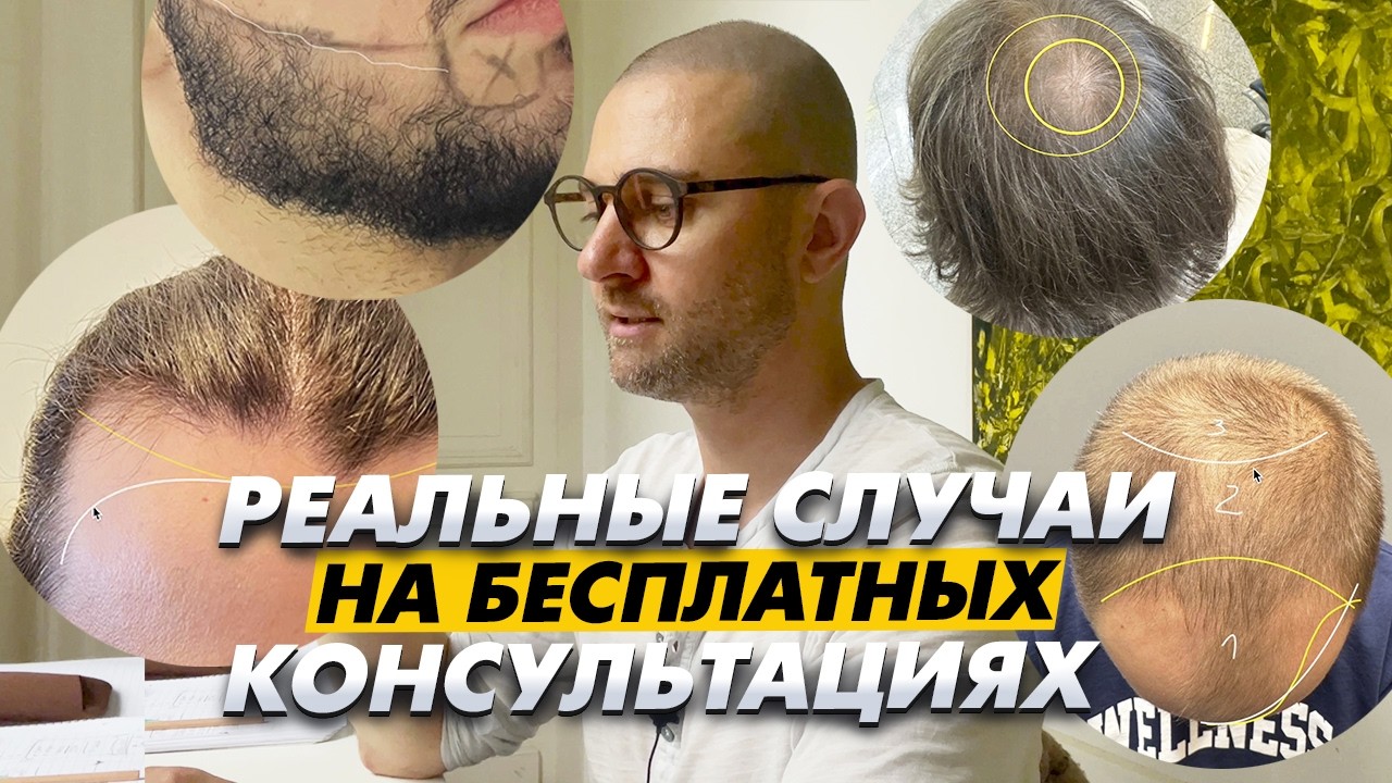 Пересадка для трансгендера  | От бороды до трансгендера \  KRASAV4IK