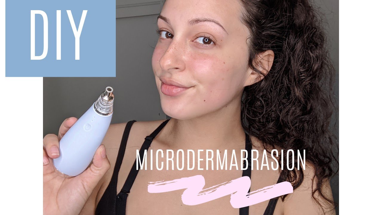 MICRODERM GLO MINI REVIEW | DIY At Home Microdermabrasion