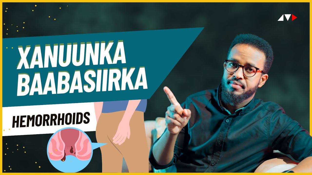 BAABASIIRKA MASAAMEYNKARAA TARANKA (Hemorrhoids) | DR ADNAN ABDALLAH
