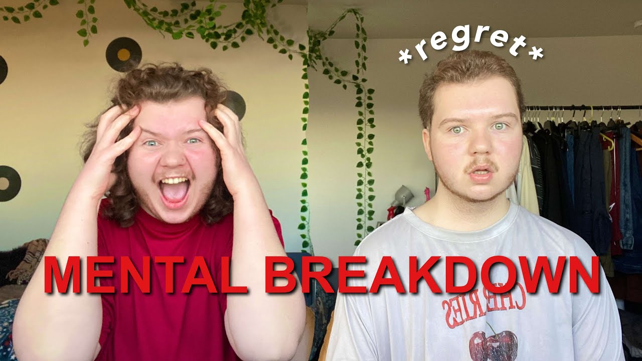 The Stages Of Going Bald