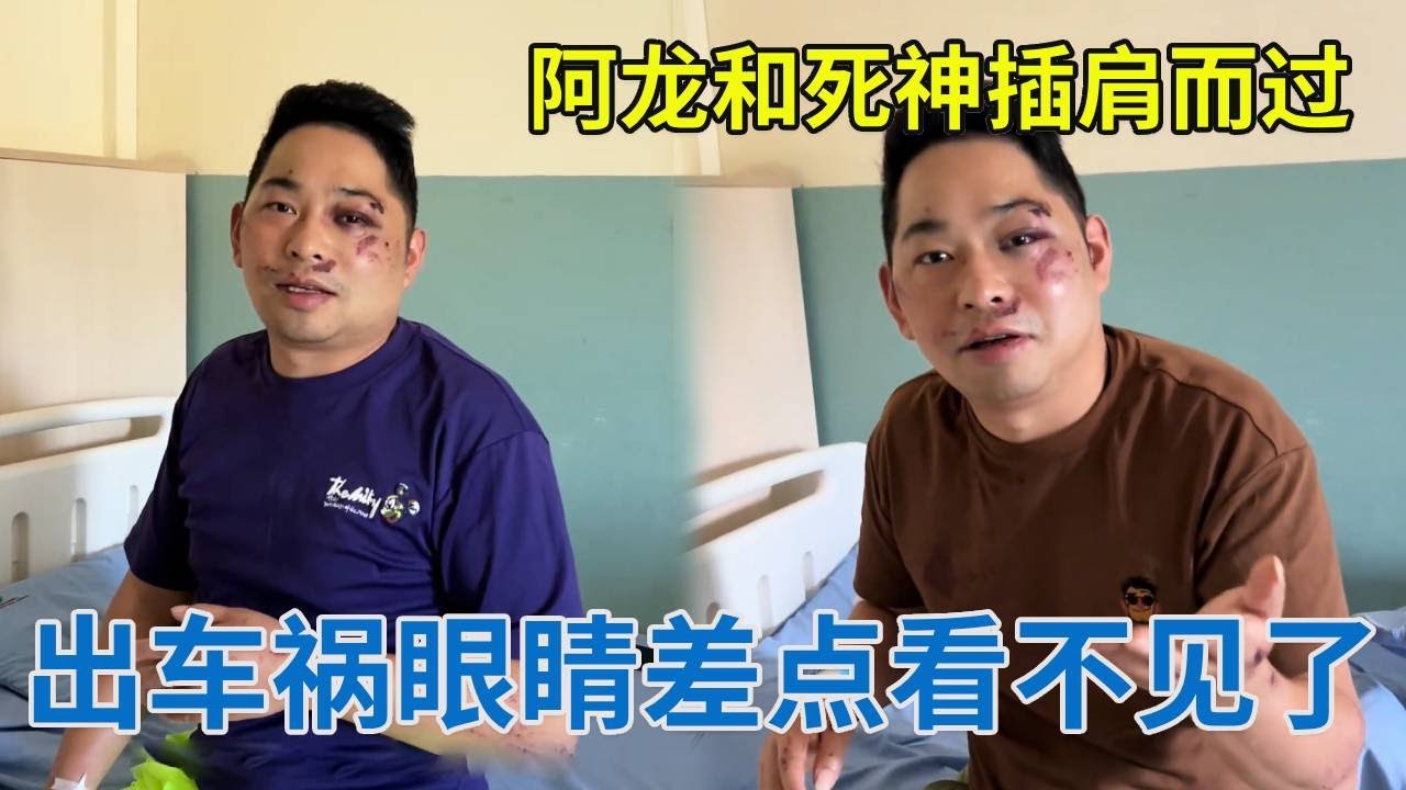 阿龙和死神插肩而过，骑摩托出车祸眼睛差点都看不见了，现在住院还好有冬梅陪床！【阿龙游四方】