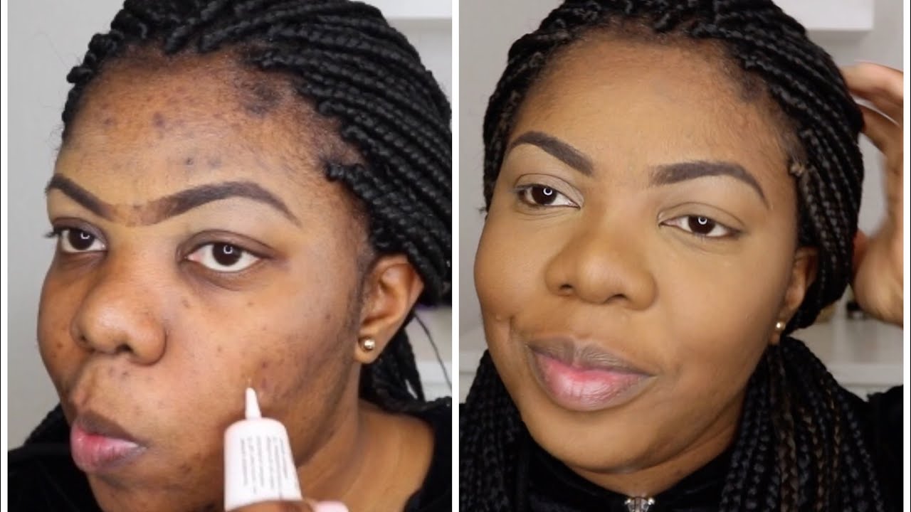 TEINT PARFAIT | ASTUCE POUR CACHER SES TACHES  | ACKY AKOUSTIK