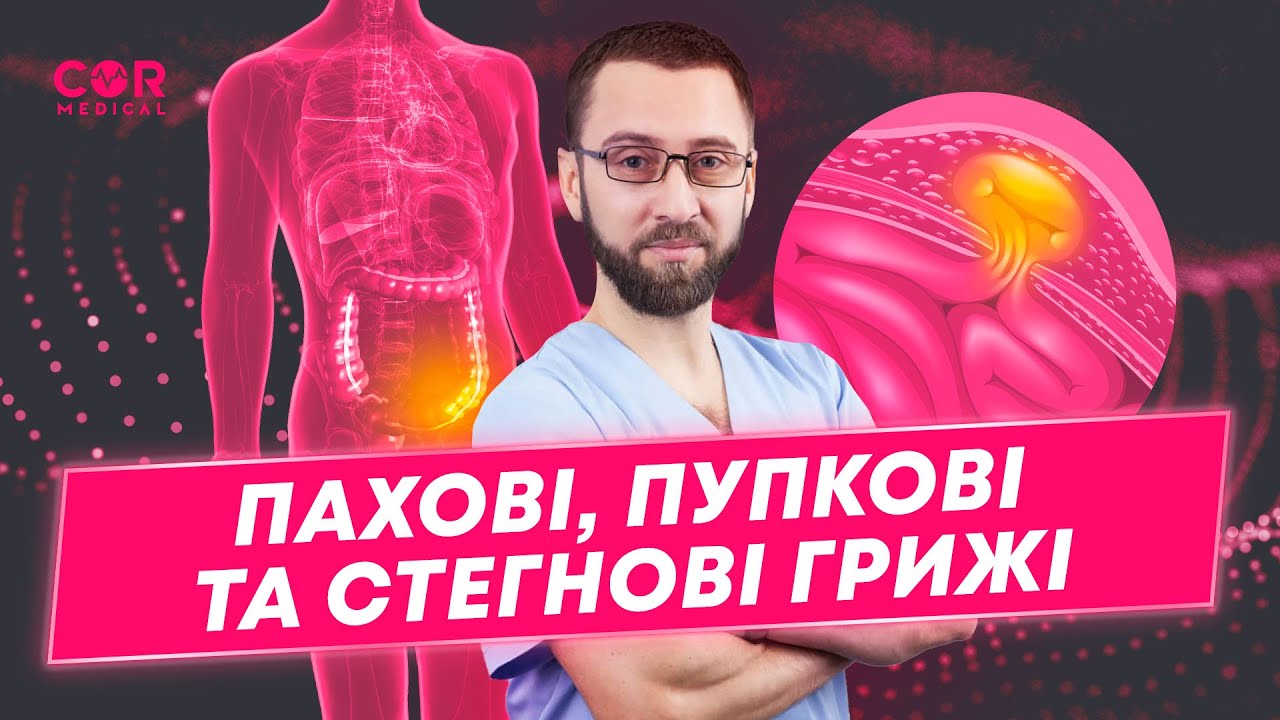 Грижа живота: що робити? Причини, симптоми та методи лікування пупкової, пахової, стегнової грижі