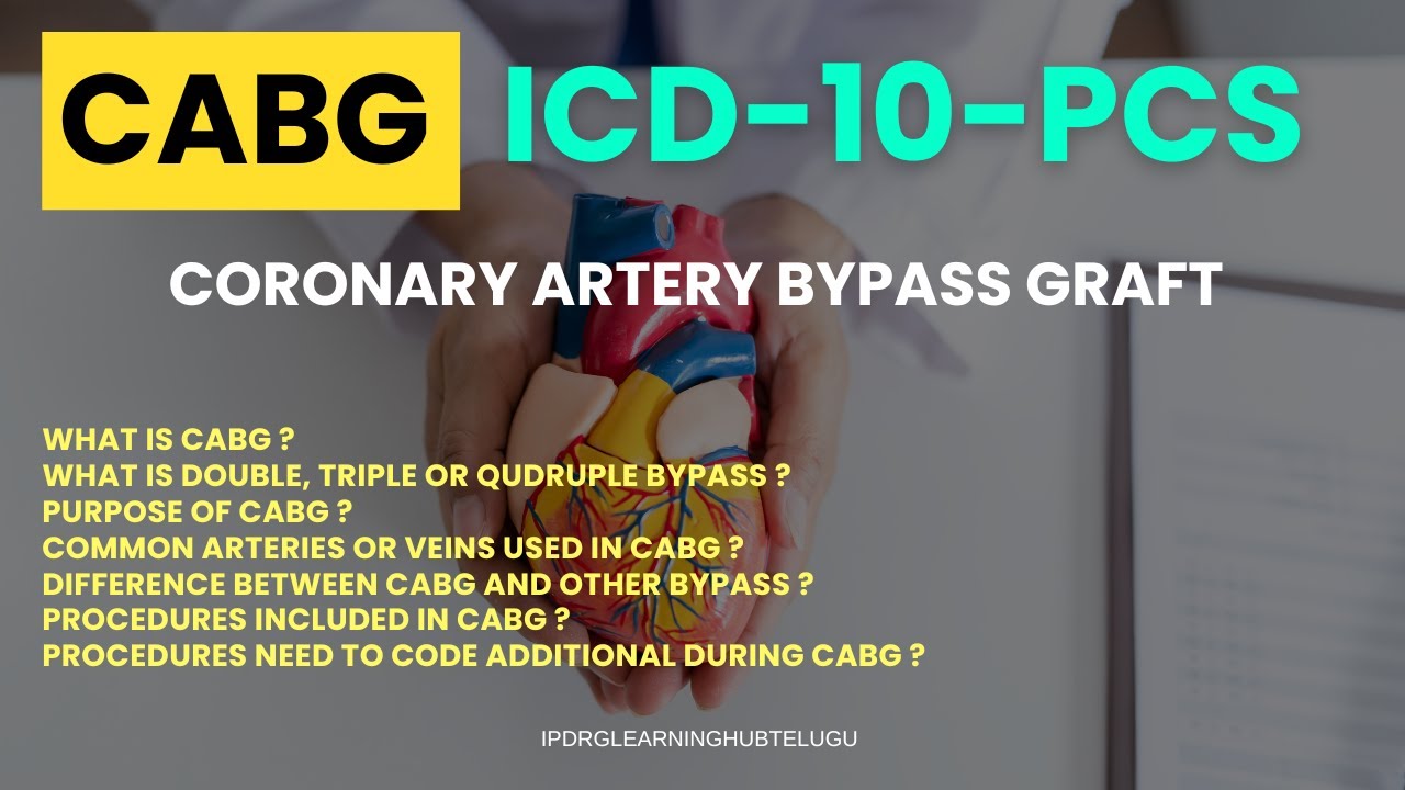 CABG Procedure coding. ICD-10-PCS
