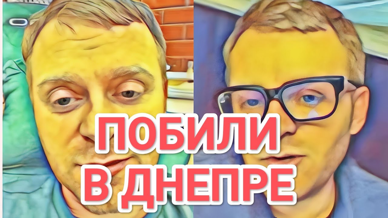 Самвел Адамян ПOБИЛИ В ДНЕПРЕ / БЫЛ НА ОХОТЕ И ДАЖЕ СТРЕЛЯЛ / ПОСМЕШИЩЕ ВСЕГО ТИК ТОКА
