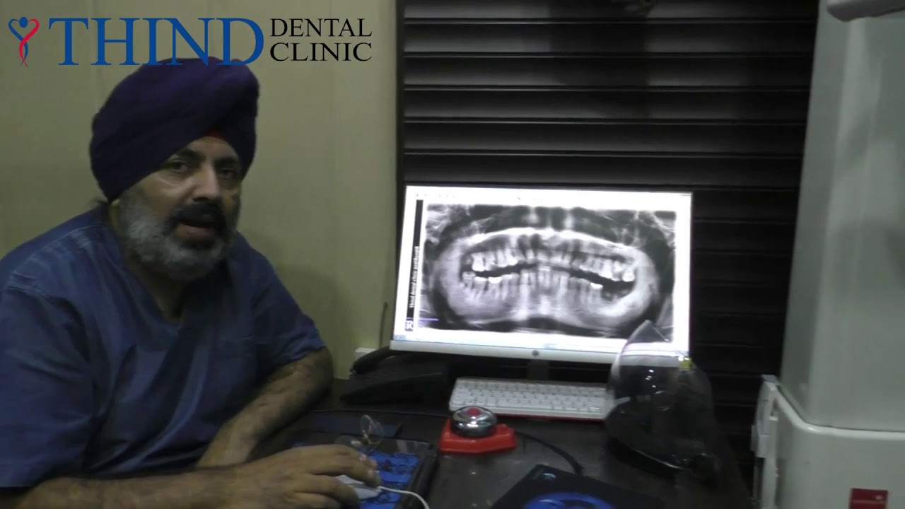 Incredible Benefits of Intraoral Cameras for Dentists and Patients