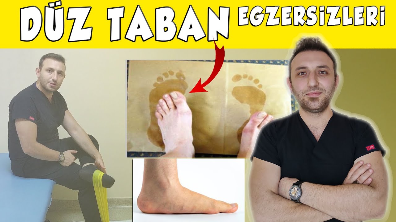 D&uuml;z Tabanlık (Pes Planus) Tedavisi | Ayak Kavisini Oluşturan En Etkili Egzersizler