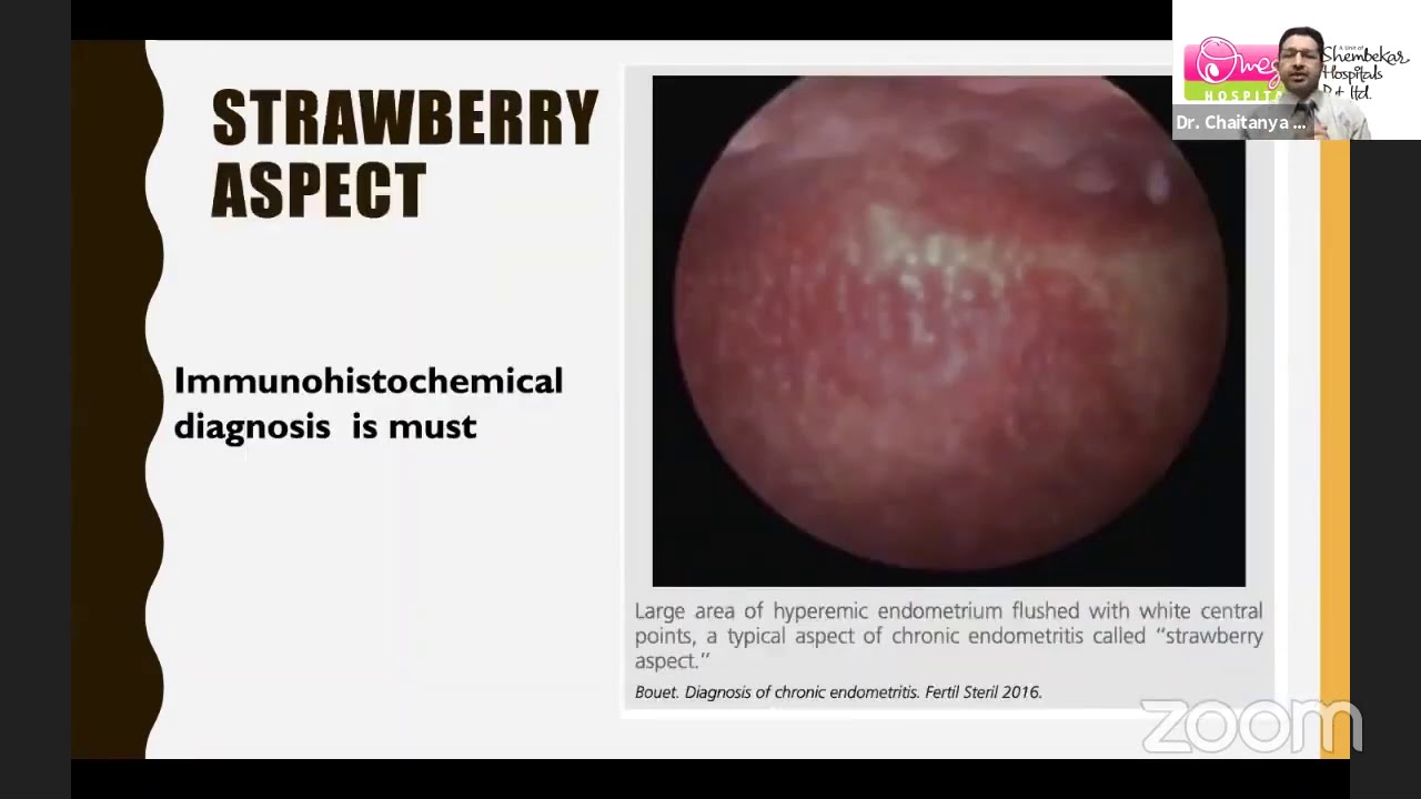 Webinar on Pre IVF Hysteroscopy By Dr Chaitanya Shembekar