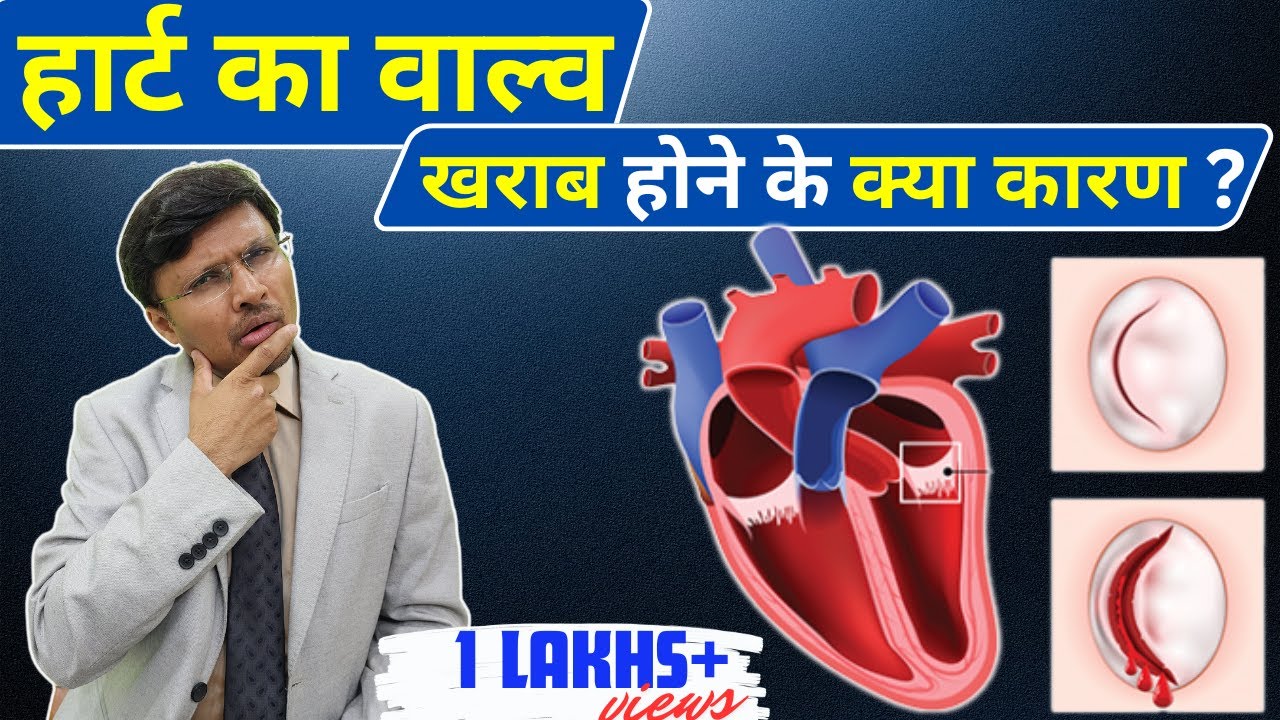 Heart Valvular Regurgitation, Symptoms, Surgery Recommendation