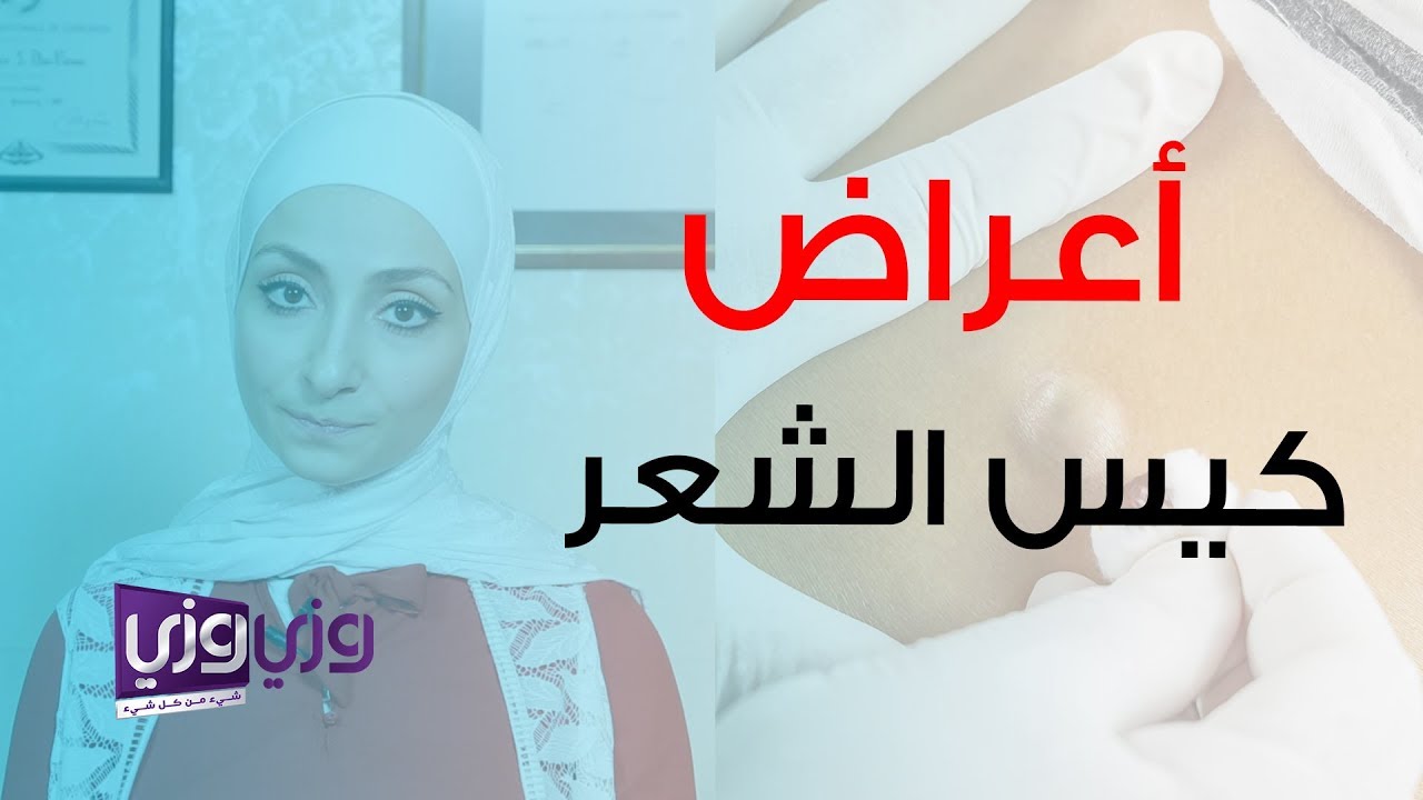 أعراض كيس الشعر