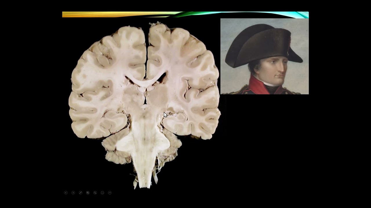 Subcortical CNS