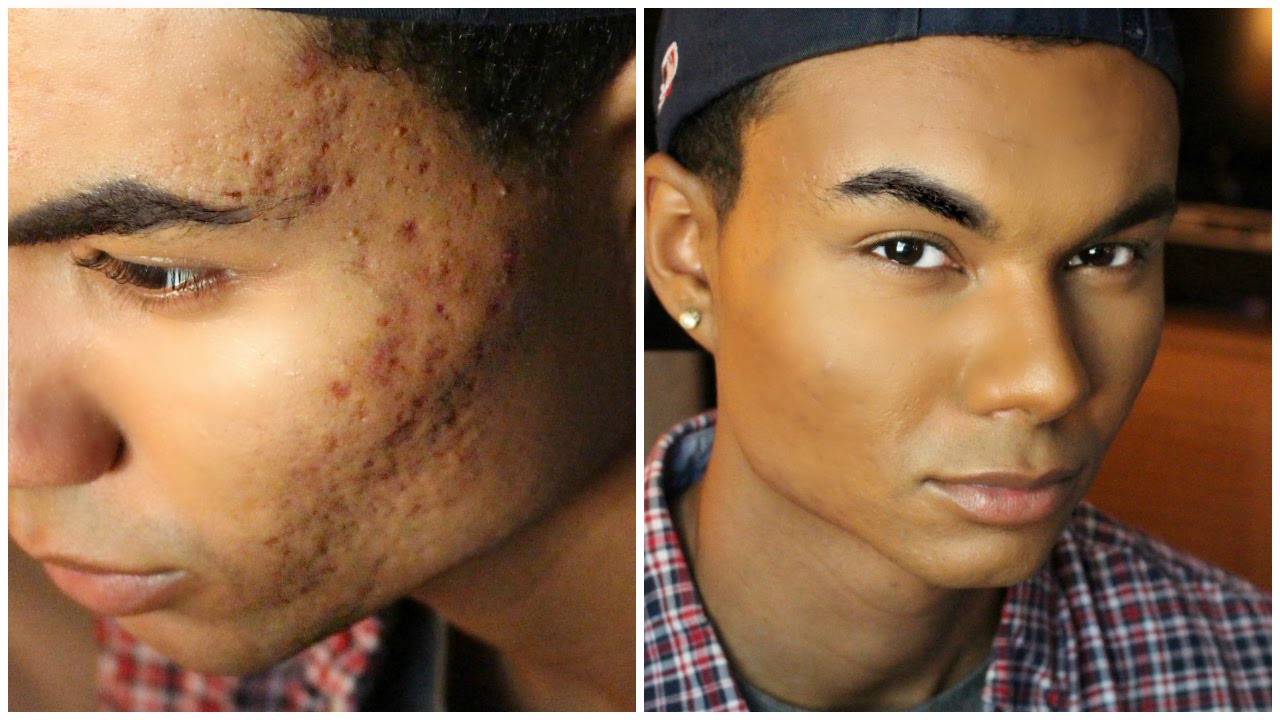 Drug Store Foundation Routine for Men - Acne & Acne Scarring Coverage