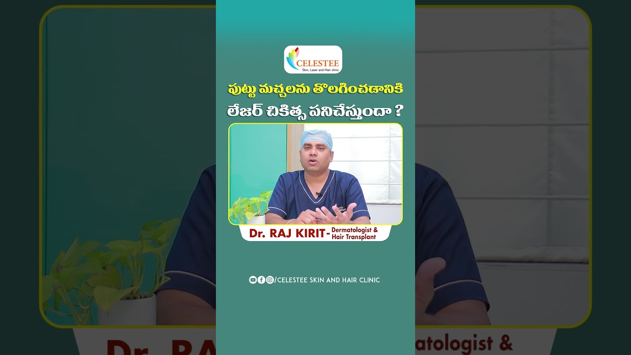 Laser Treatment for Birthmarks Removal || Dr Raj Kirit || Celestee Skin And Hair Clinic #shorts