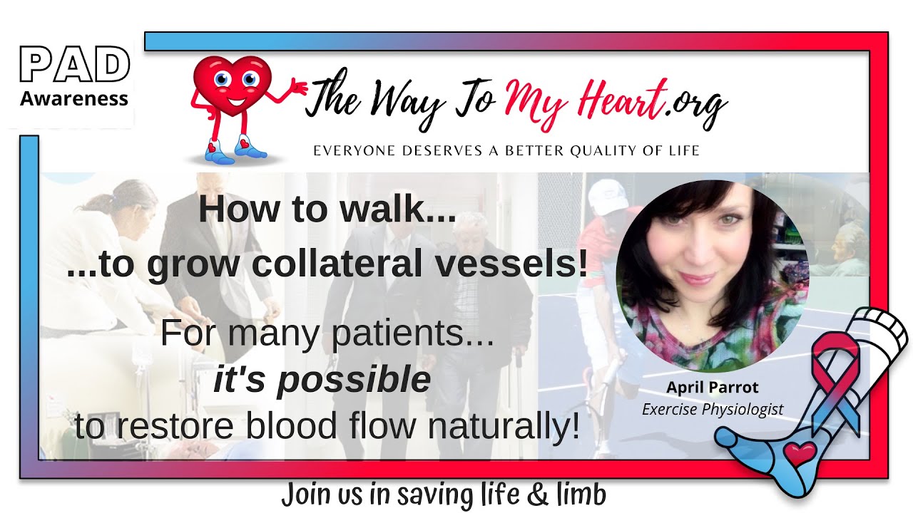Peripheral Artery Disease: How To Grow Collateral Vessels by Walking