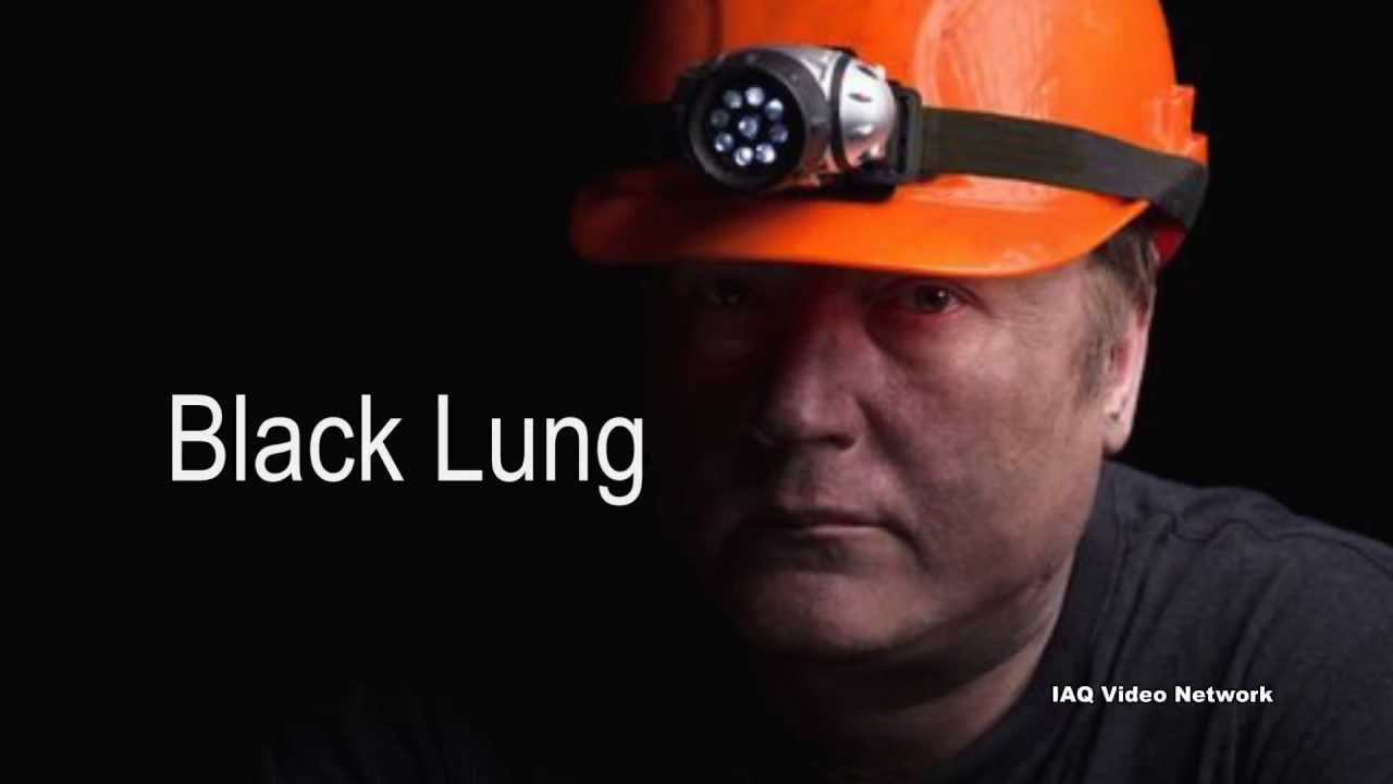 Coal Dust Exposure and Black Lung Disease