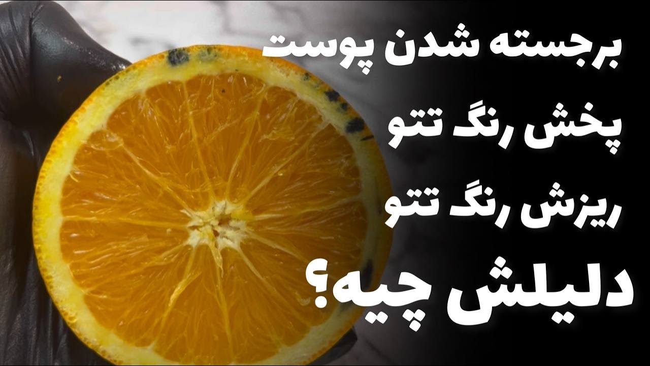 علت برجسته شدن پوست بعد از تتو