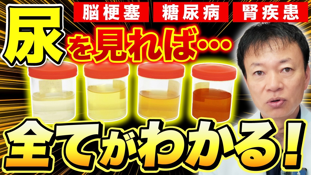 【危険】その尿、腎不全のサインかも…絶対に見逃してはいけない「おしっこ」からのSOSと糖尿病の関係について徹底解説します
