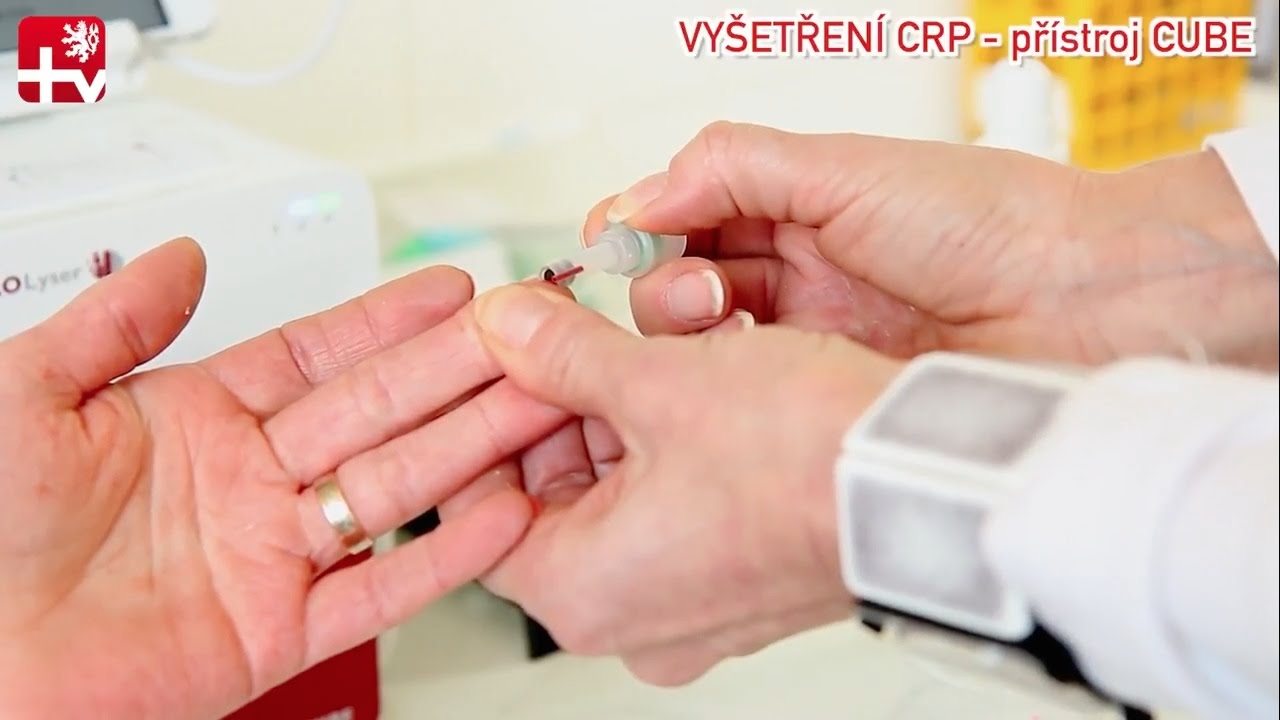 POCT přístroje QuickSeal v každodenní praxi společnosti Medica Sever