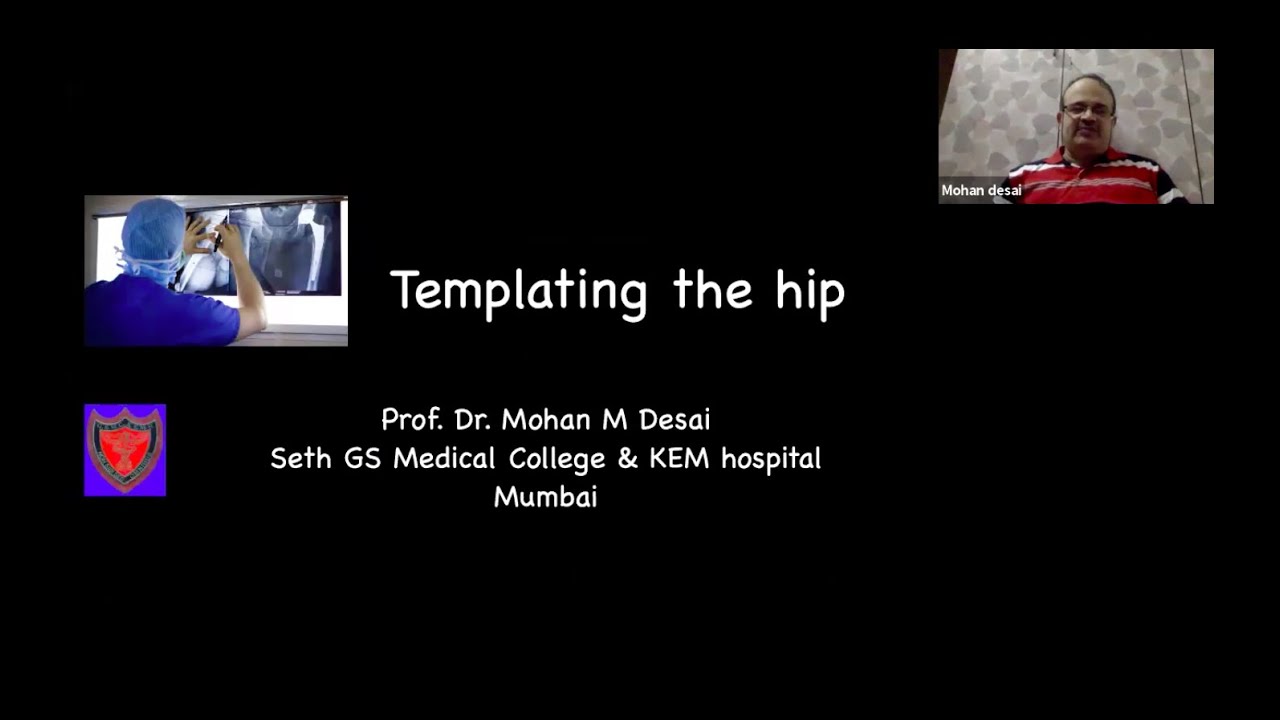 Templating of Hip Joint by  Dr Mohan Desai