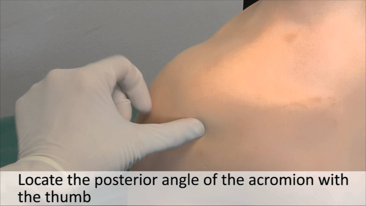 Musculoskeletal Examination and Joint Injection Series_ Shoulder Joint Aspiration(Posterior)