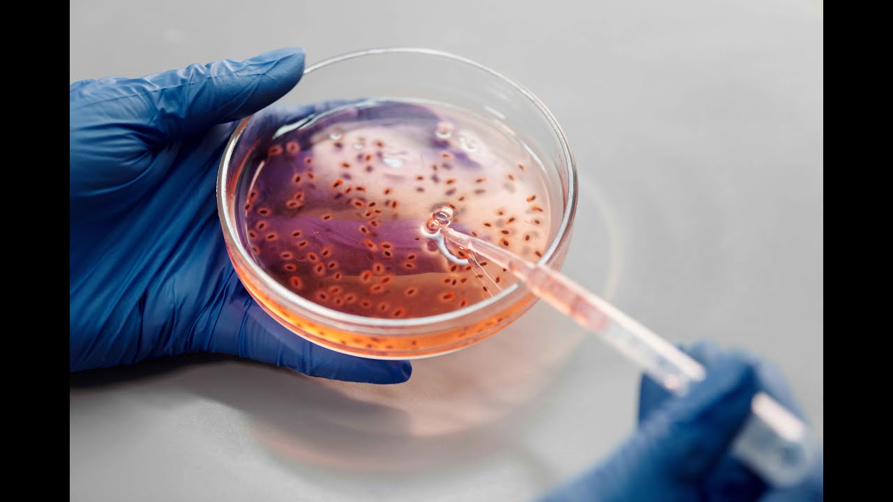 Positive News - Common Bacteria Turns Plastic Bottles into the Painkiller Acetaminophen Paracetamol