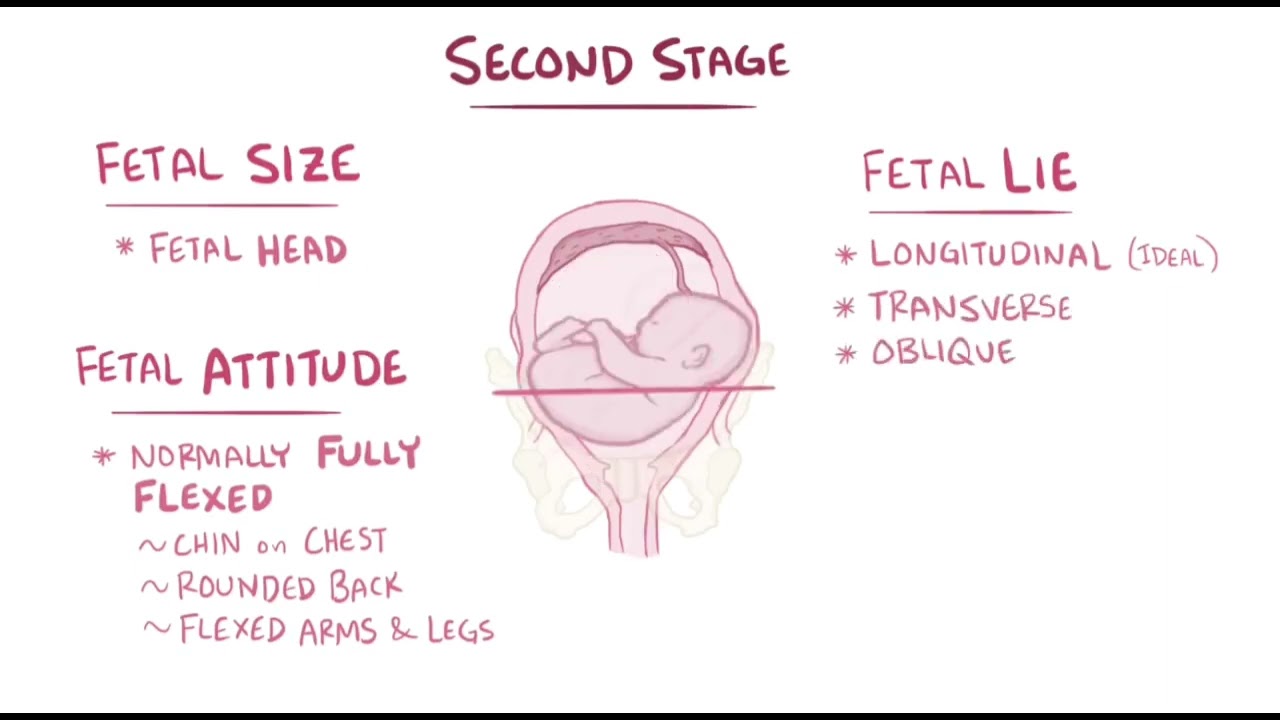Stages of labor - physiology #labor #obstetrics #gynecology #examchallenge 