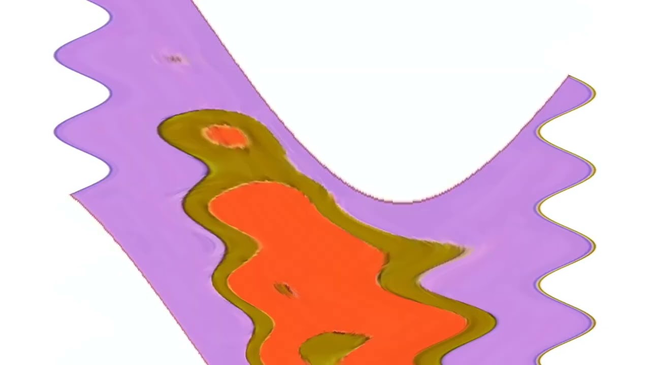 PBS Kids Dash Logo Effects Part 2 In Something