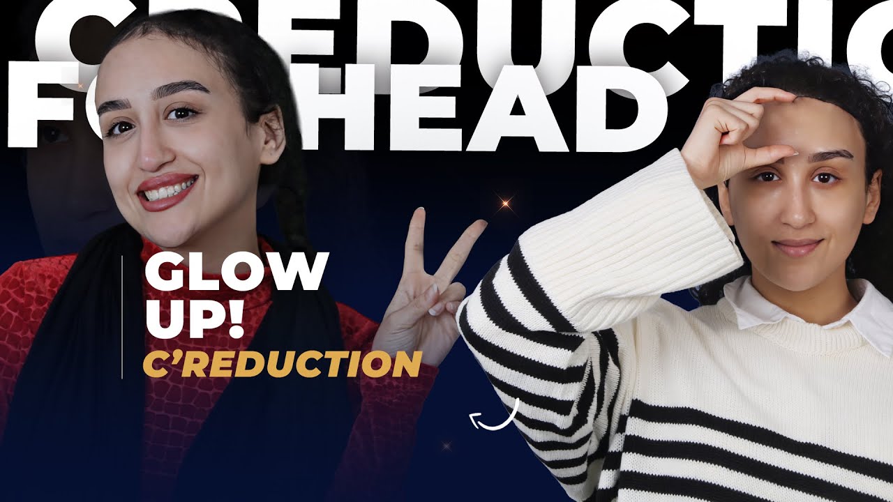 Istanbul: My Experience with Forehead Reduction Surgery!