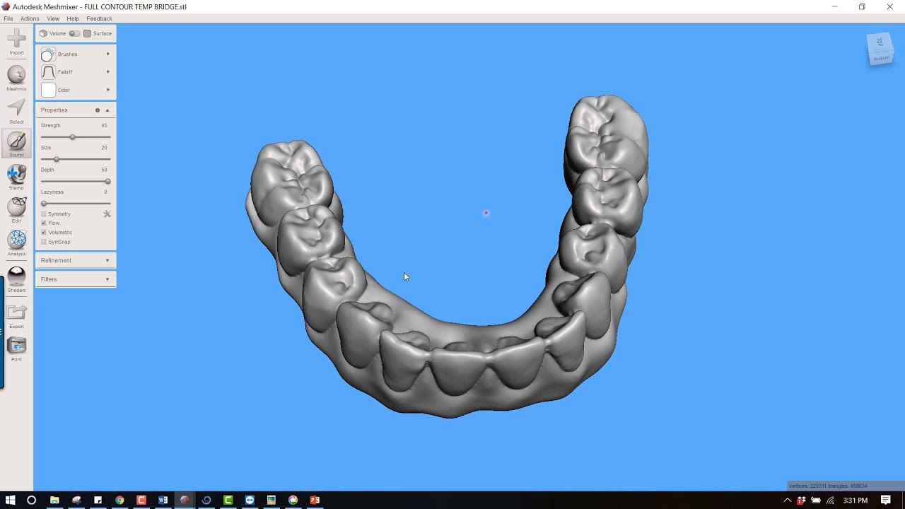 Creating a Shell Denture for Full Arch Immediate Conversion