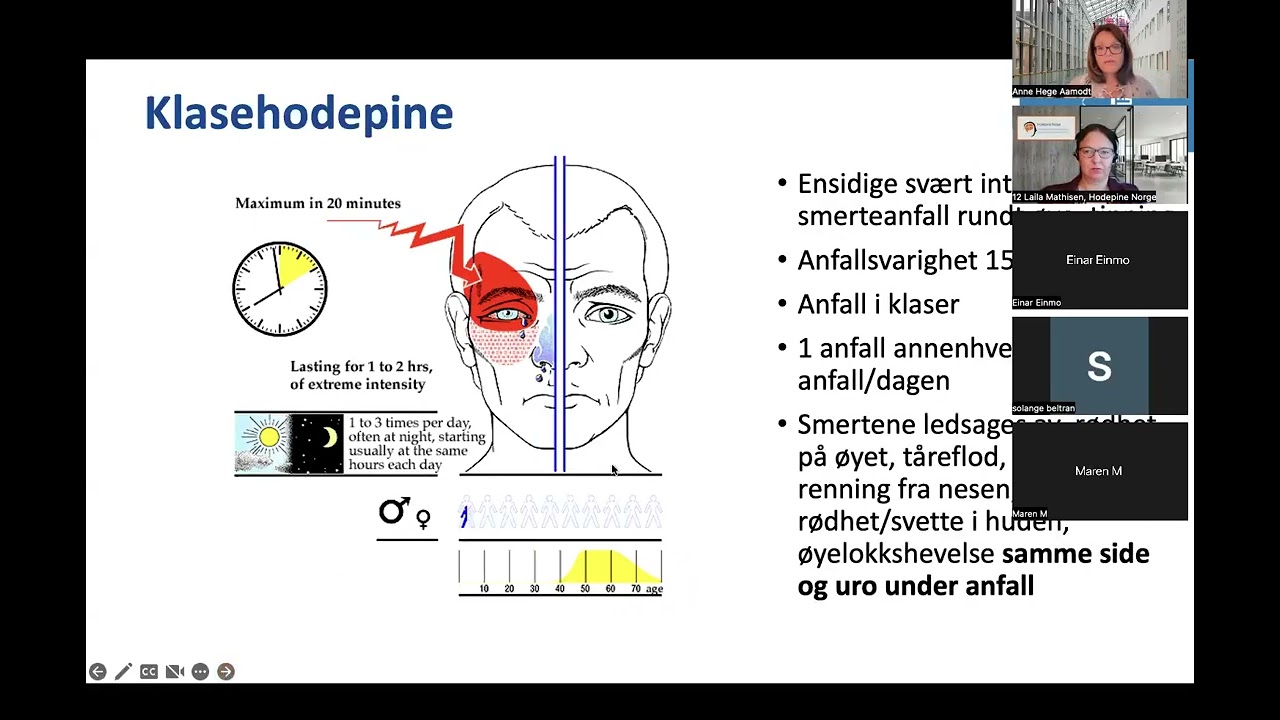 Klasehodepine - siste nytt om forskning og behandling