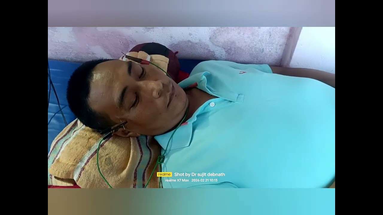 Facial paralysis right side 