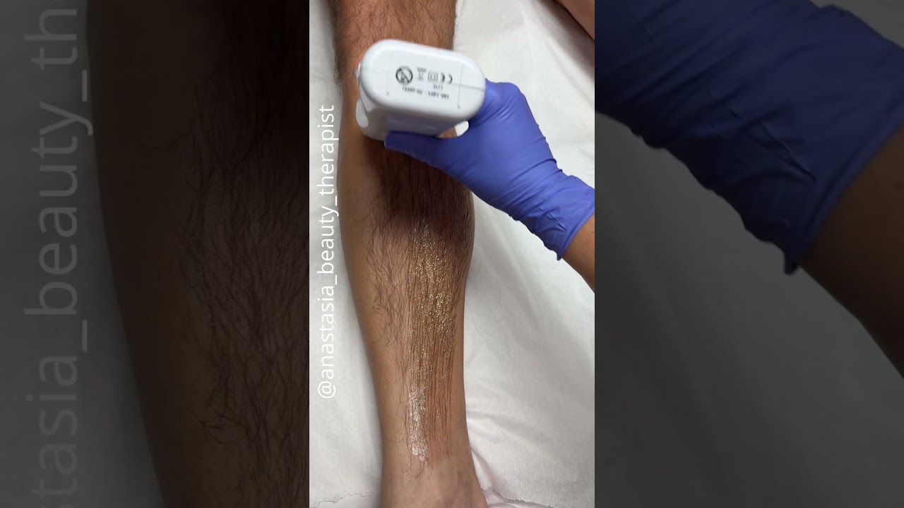 Male lower leg wax service using coral roll on soft wax cartridge system from Starpil