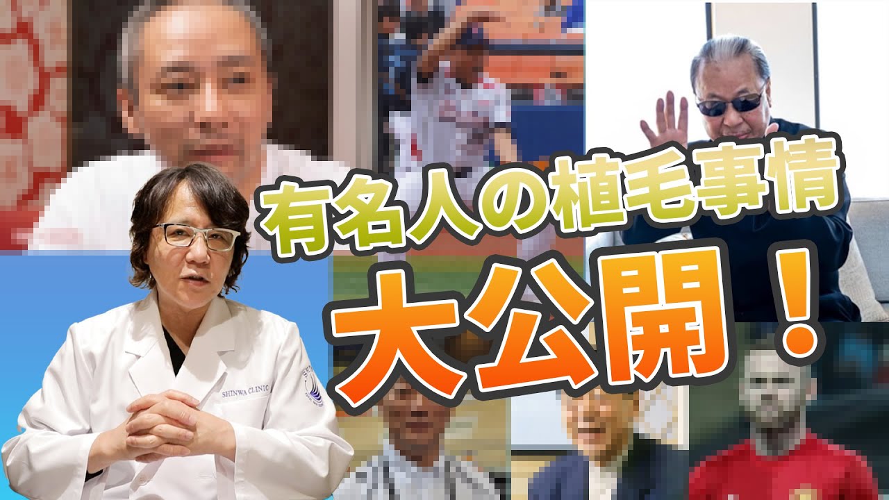 【自毛植毛】自毛植毛手術を受けたと公表してる有名人！！【植毛】【薄毛治療】