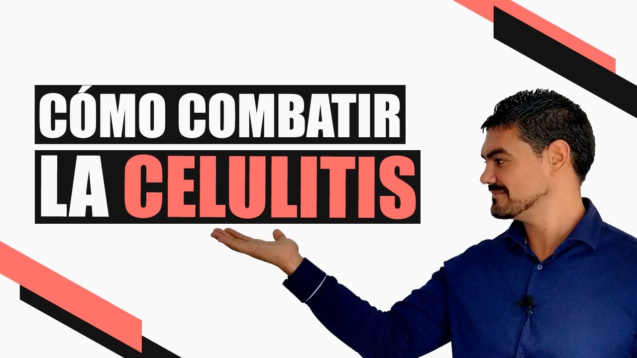 ▶️ Cómo Eliminar La Celulitis [Con 6 Sencillos Trucos]