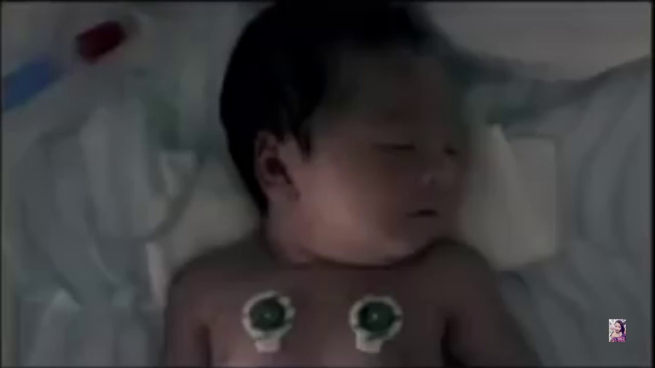 NI&Ntilde;OS GEMELOS, UNO  NACE MUERTO!!! MIRA LO QUE SUCEDE...
