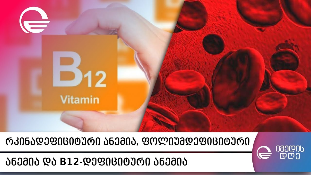 რკინადეფიციტური ანემია, ფოლიუმდეფიციტური ანემია და B12 დეფიციტური ანემია