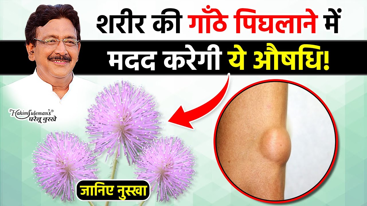 लाजवंती के बीज पिघलाएंगे शरीर की गाँठे !