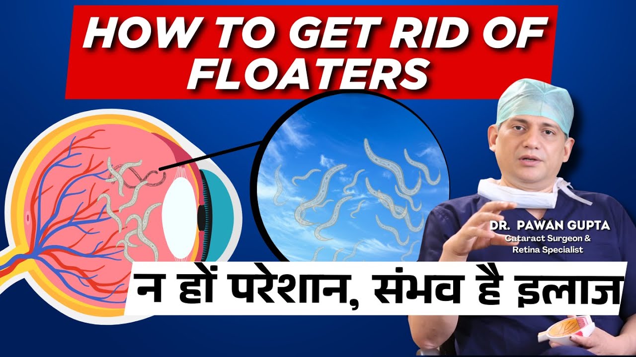 Floater’s से ना हों परेशान, Treatment is Possible / Dr. Pawan Gupta
