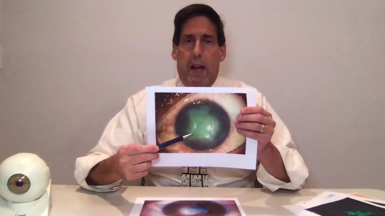Dr. Alan Mendelsohn  - Herpes Simplex Virus