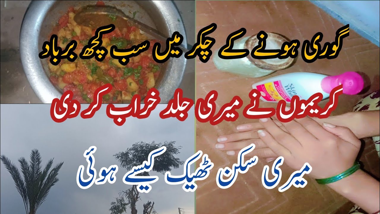 Stop Using Whitening Creams | My Skin Story & Natural Acne Solution