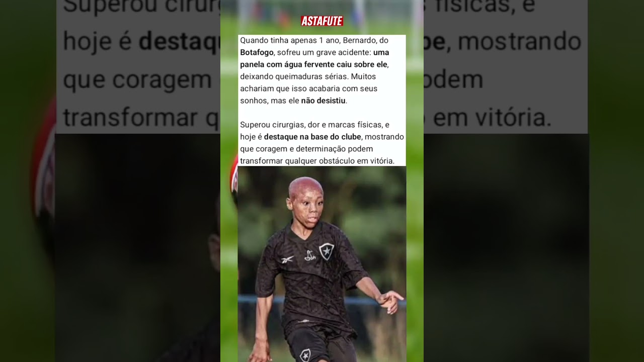 BERNARDO: DE ACIDENTE GRAVE NA INF&Acirc;NCIA &Agrave; ESTRELA DA BASE DO BOTAFOGO