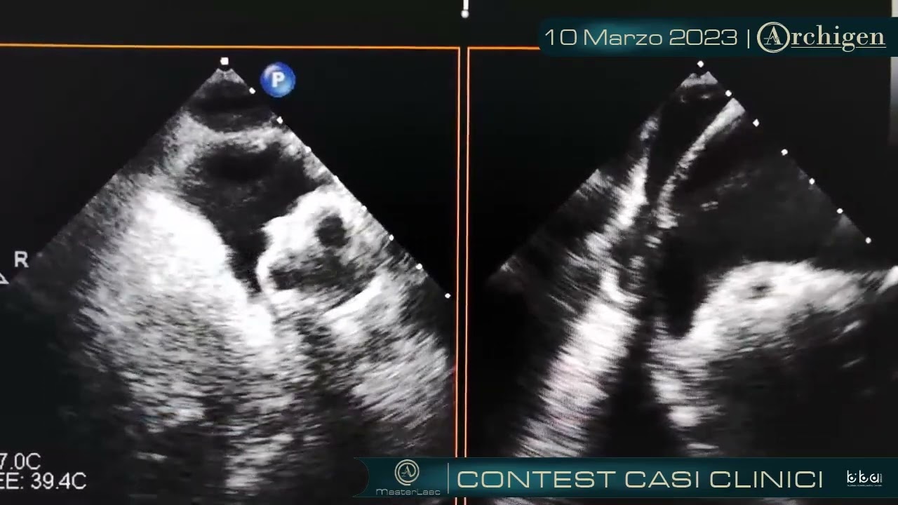 MasterLaac Contest casi clinici - 