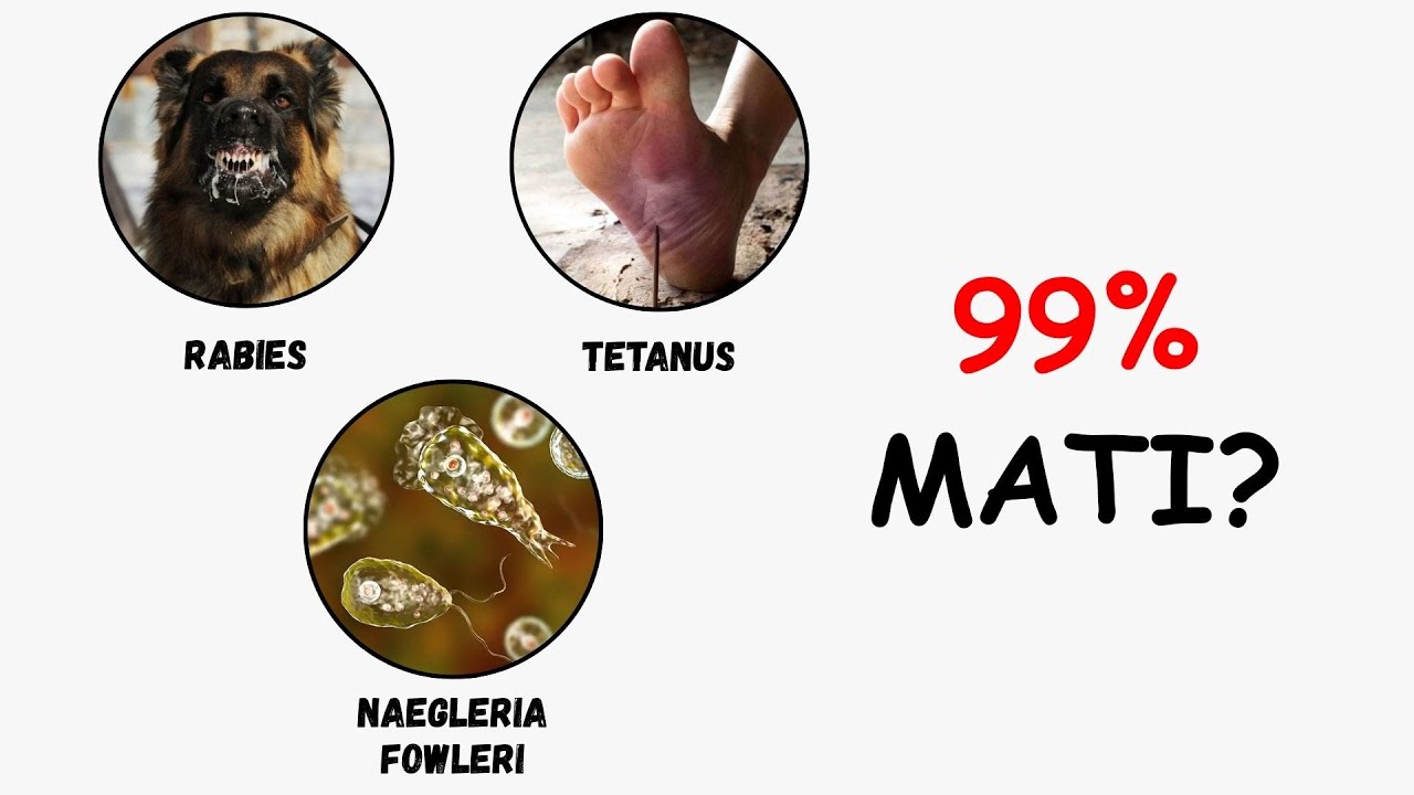 99% Mati?