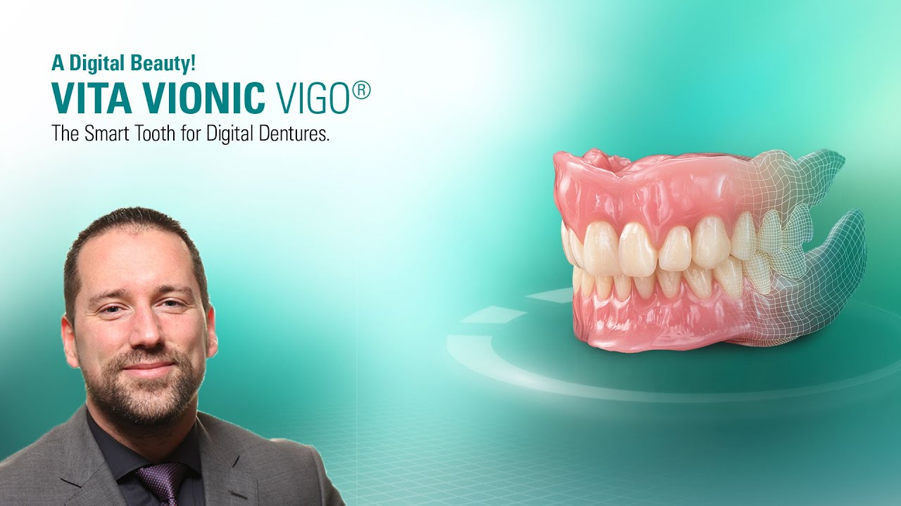 EN | EXPERT TALK | VITA VIONIC VIGO®