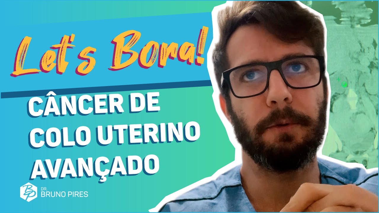 Rotina na Medicina  | Câncer de colo de útero avançado