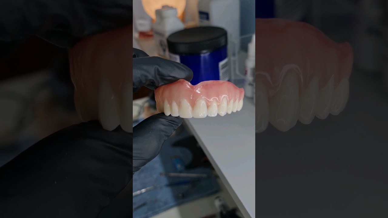 Pr&oacute;tese total levemente caracterizada! #protesedentaria #dentista #odonto #odontologia #cursoonline