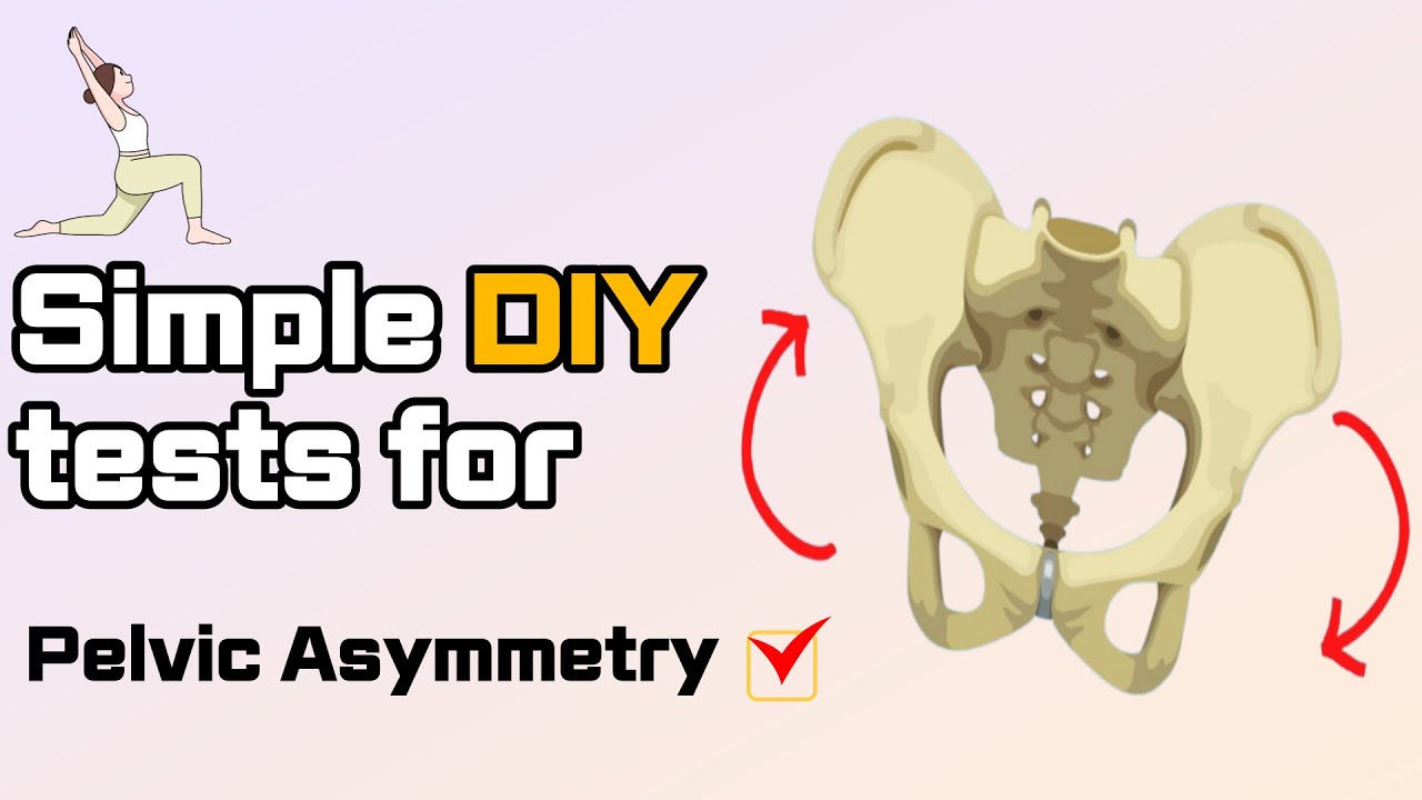 Want to check which side your pelvis is rotated to? Simple tests for Pelvic rotation/Shift/Height