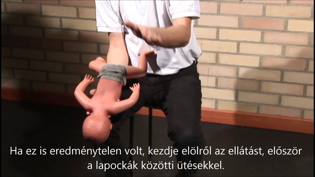 Légúti akadály eltávolítása csecsemő és gyermek esetén - feliratos