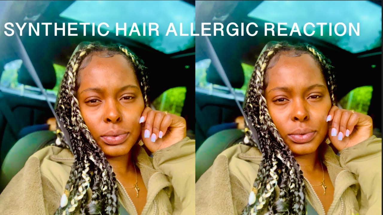 Synthetic hair allergic reaction | OMG! 😫😡 | OVERSEAS BRAIDING HAIR