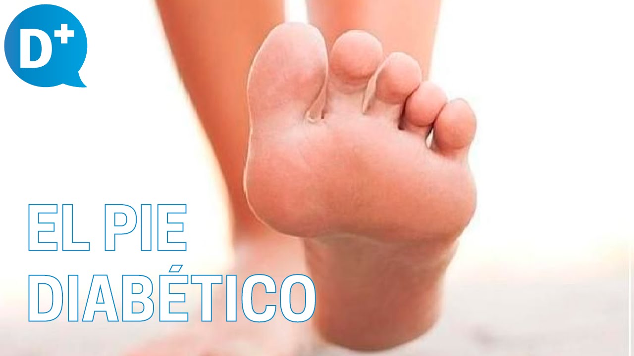 ¿Qué es el pie diabético?